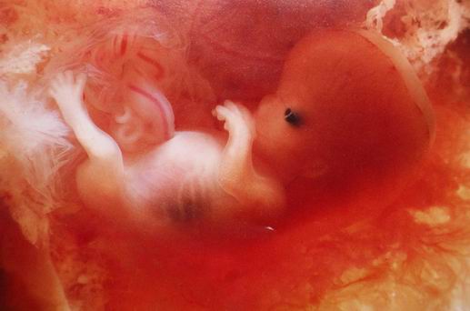 Embryo%2010%20bis%2011%20Wochen.jpg